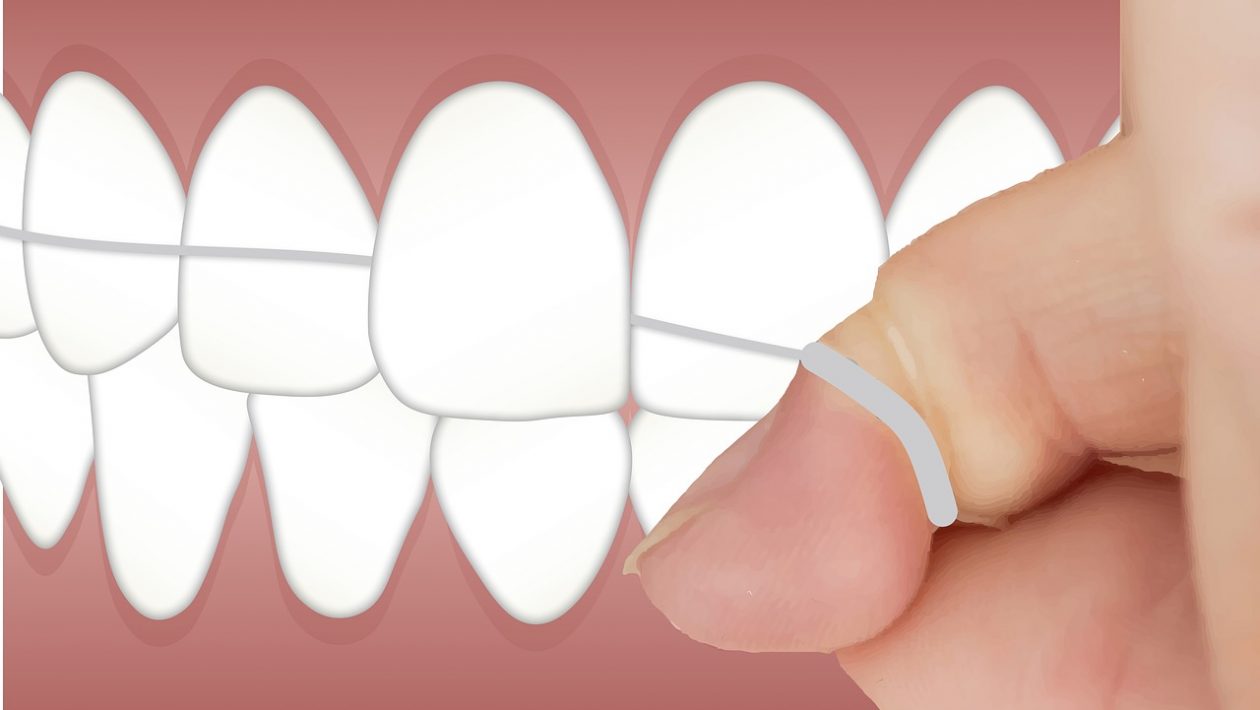 Five Effective Ways to Prevent Dental Cavities