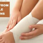 How To Treat a Sprained Ankle